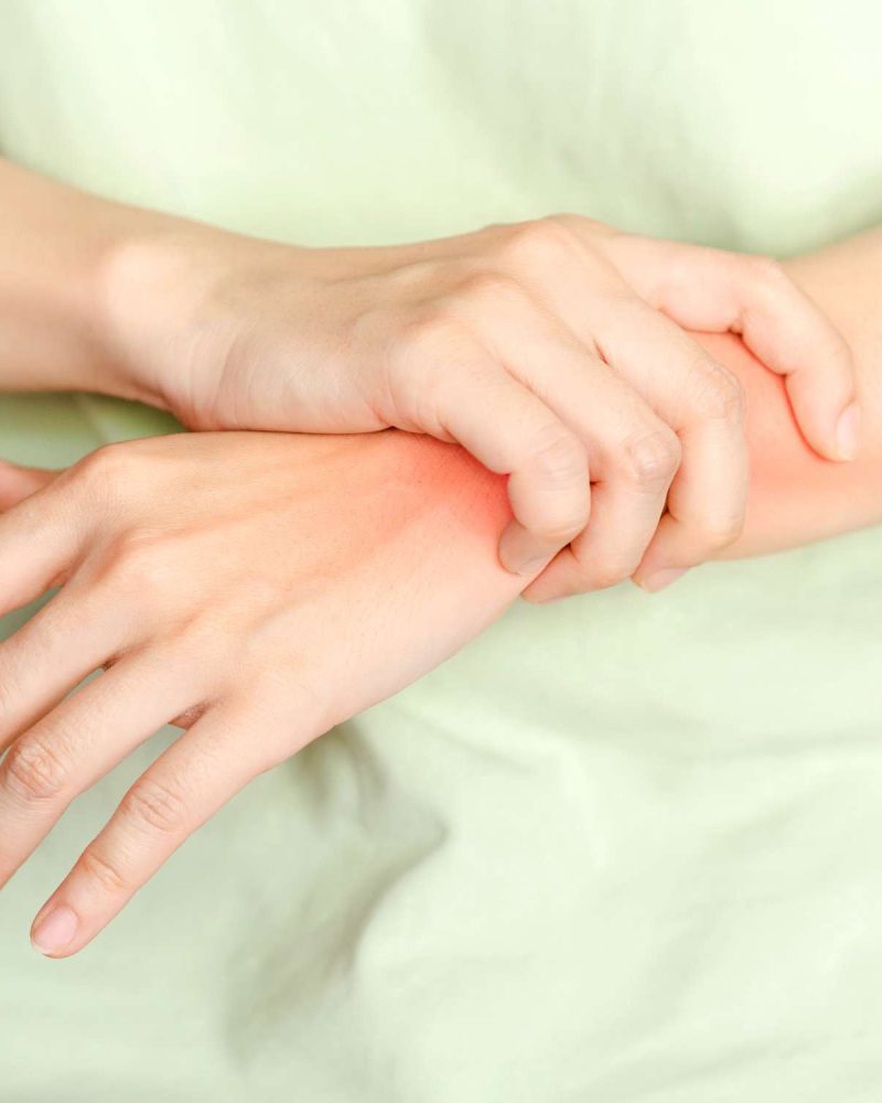 Physical Therapy for Rheumatoid Arthritis